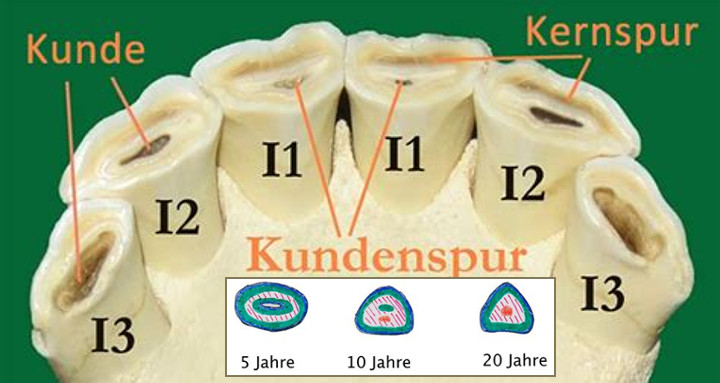 Kundenspur an den Schneidezähnen